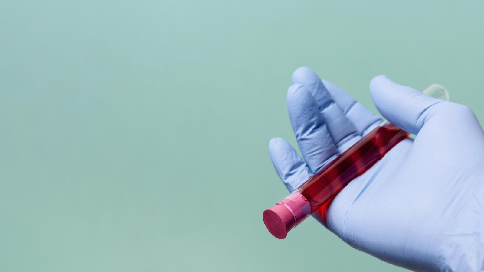 Лютеинизирующий гормон (ЛГ)