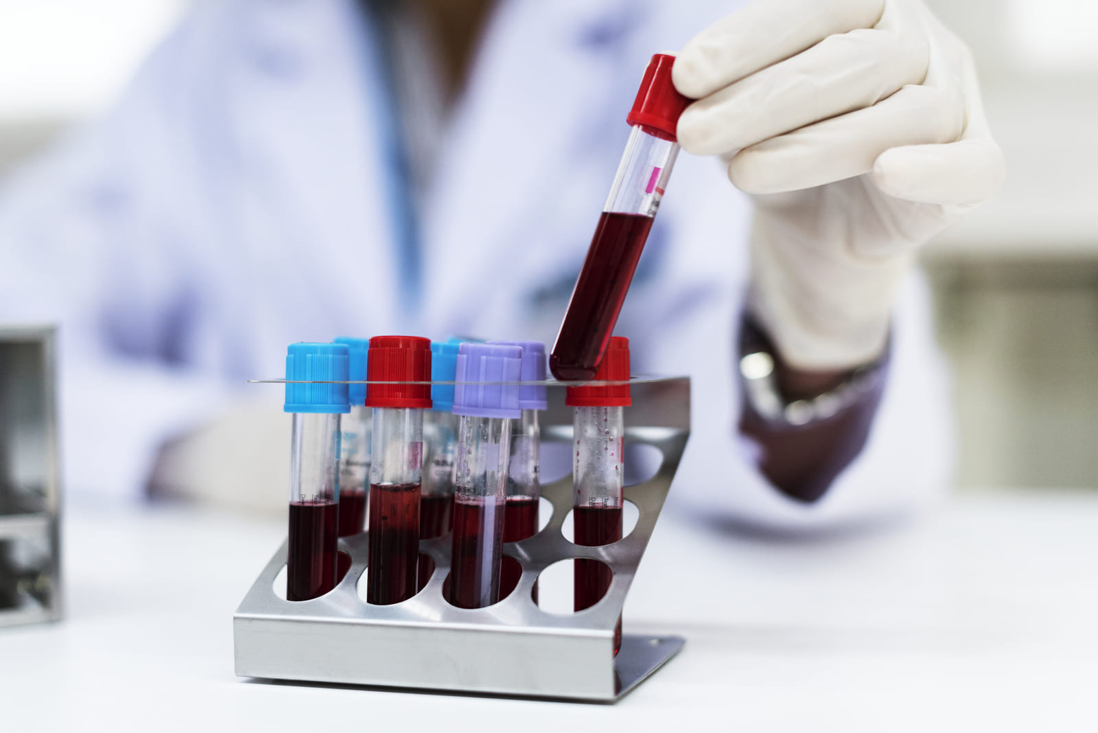 Антимюллеров гормон (АМГ, AMH)