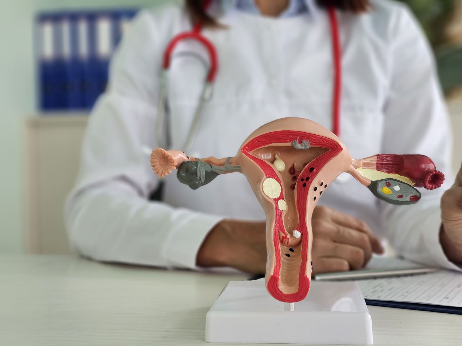 Умеренная дисплазия шейки матки