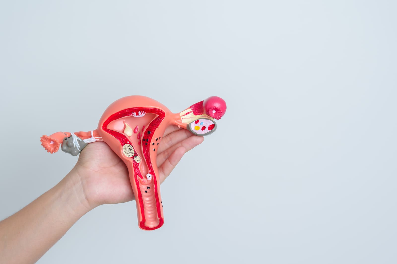 Киста яичника при беременности