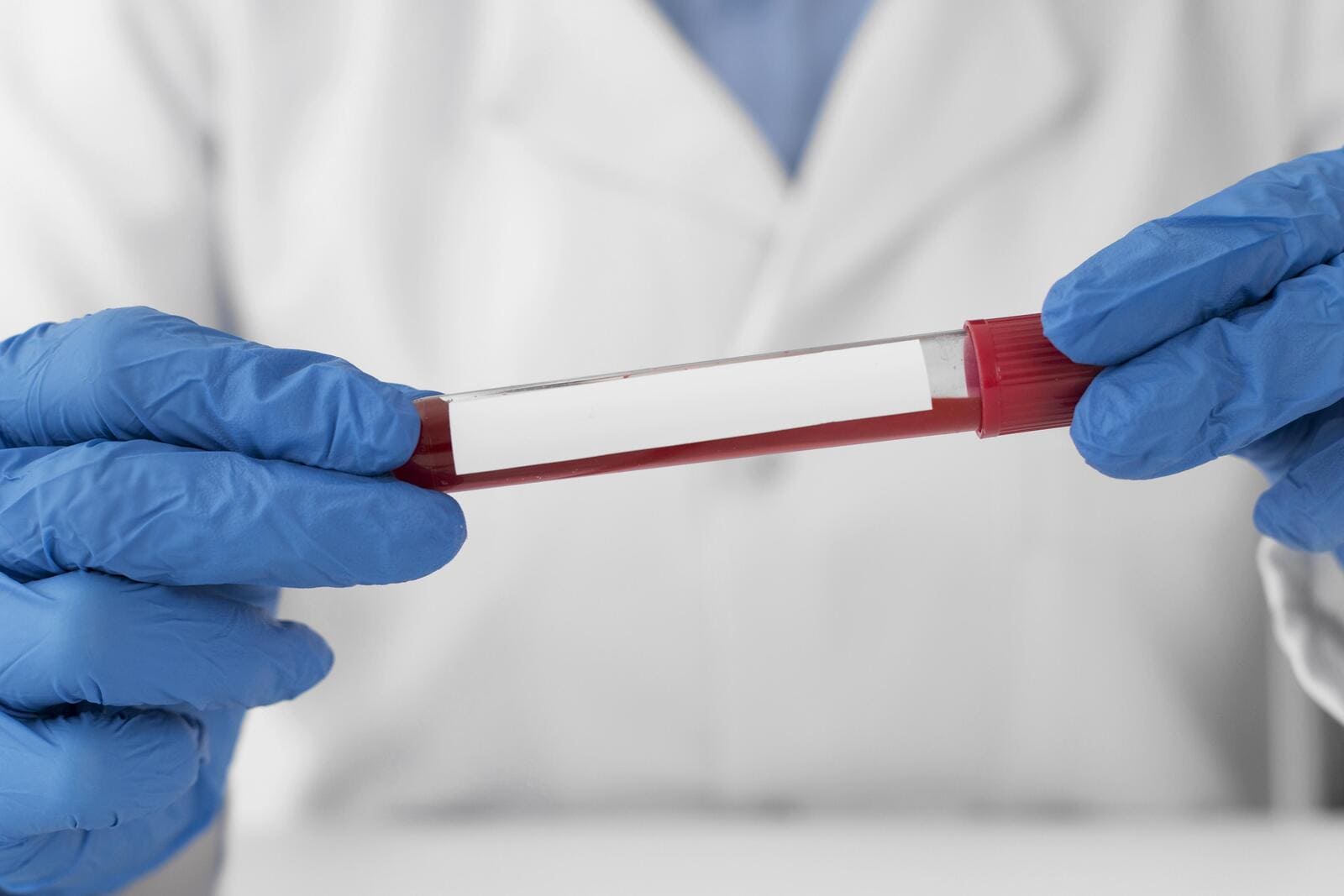 Оценка функционального резерва яичников