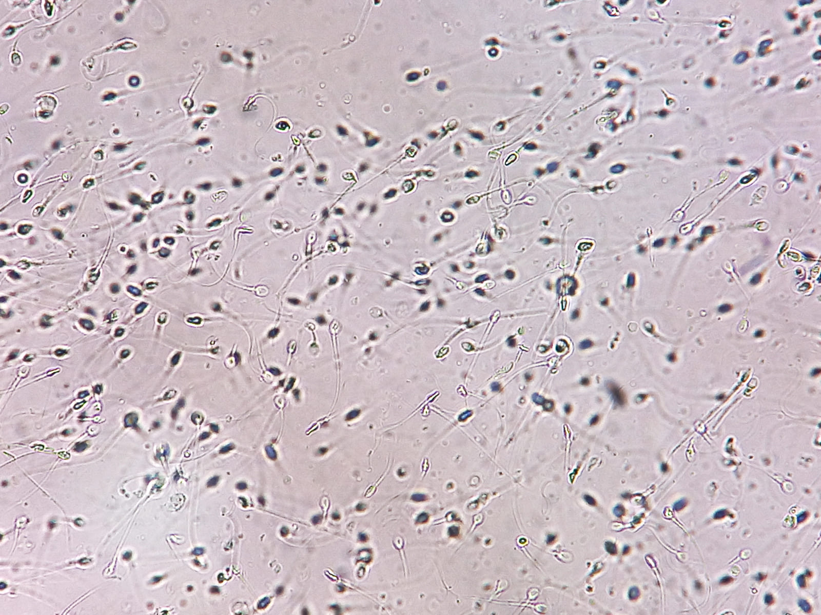 Спермограмма