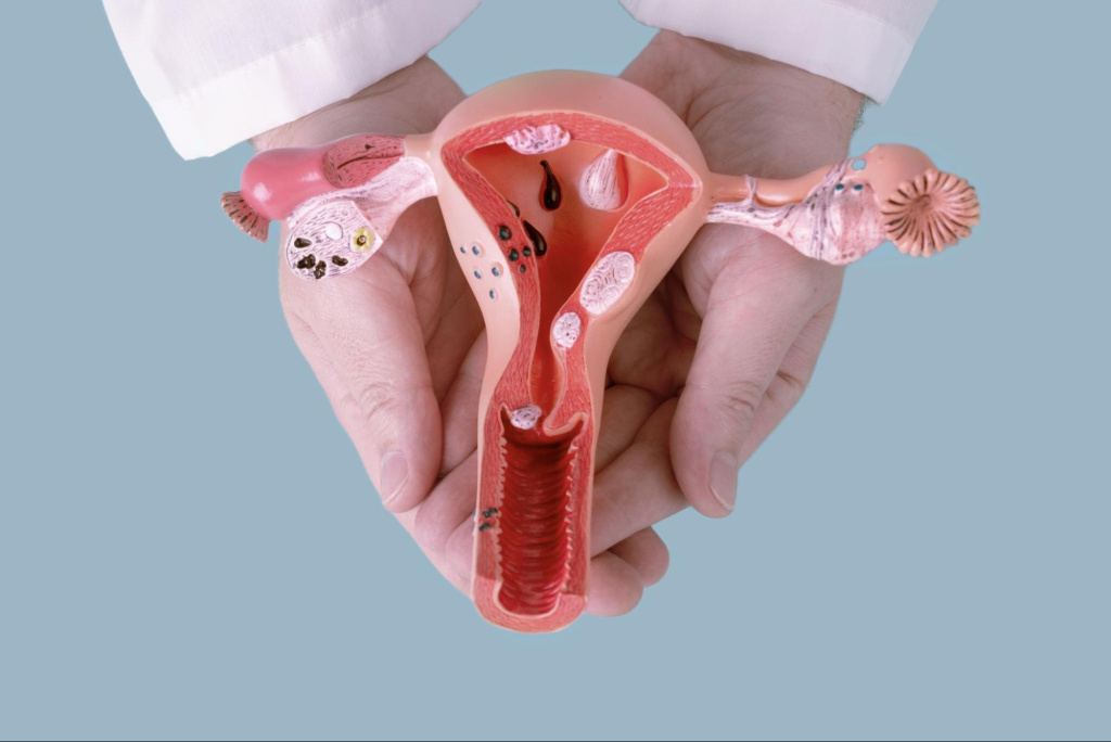 Эктопия шейки матки: причины, симптомы и современные методы лечения